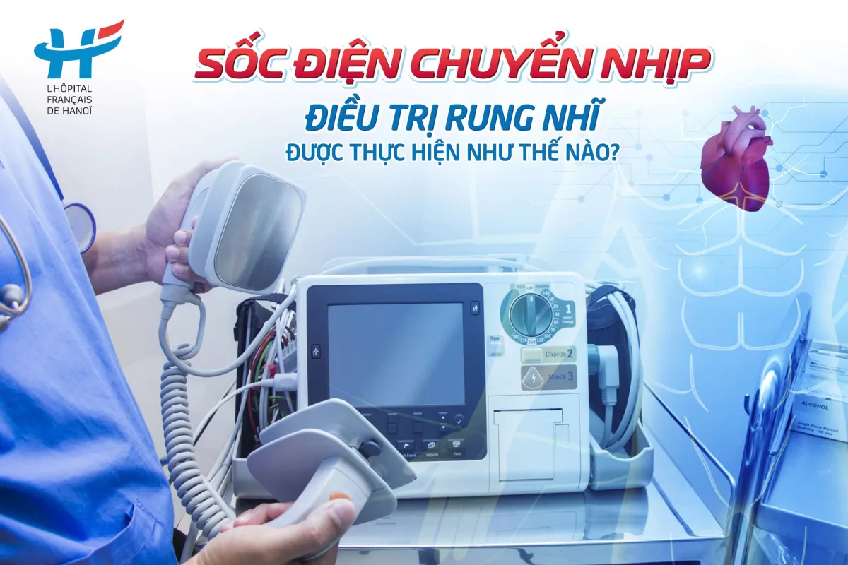 Sốc điện chuyển nhịp trong điều trị rung nhĩ được thực hiện như thế nào?